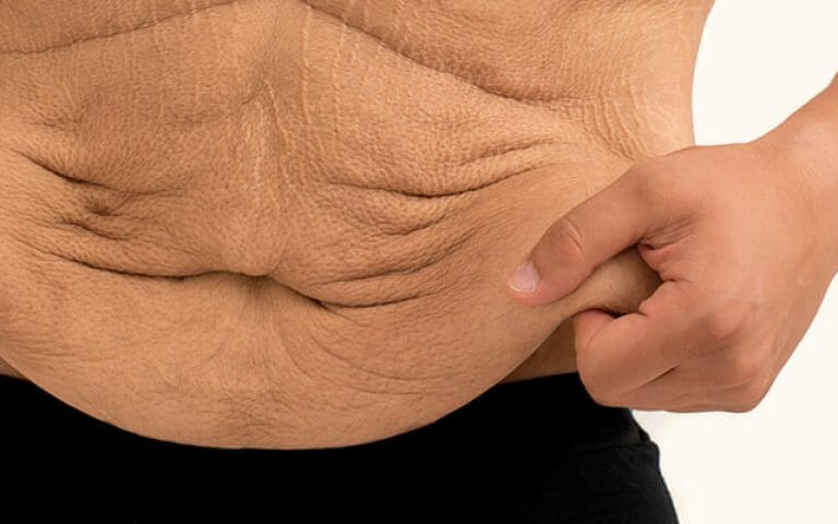 cirurgia plástica de abdômen